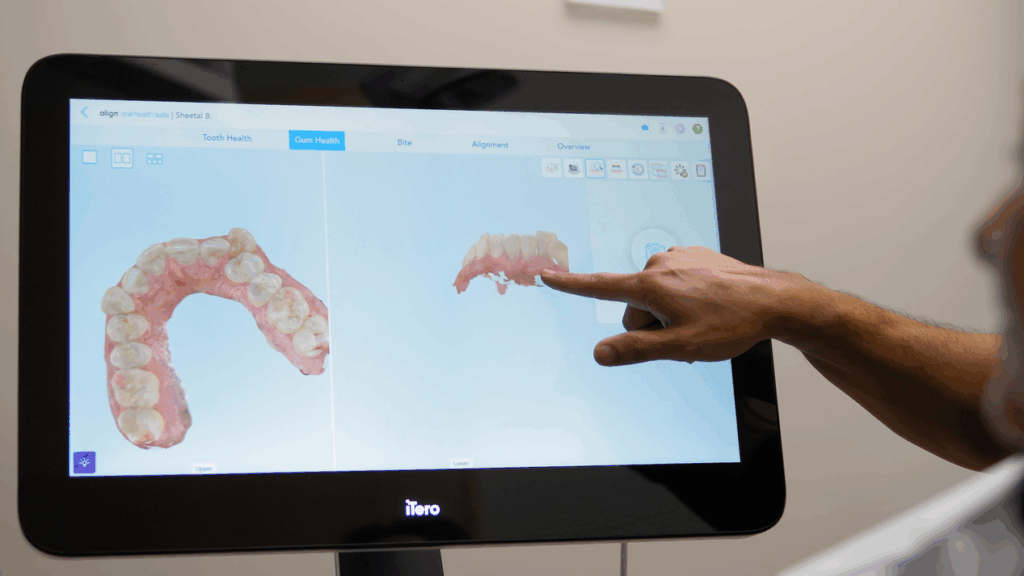 Dental exam in NW Calgary Family Dentist